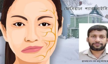 বেল্স পালসি বা মুখ বেঁকে যাওয়ায় ফিজিওথেরাপি মেডিসিন এন্ড রি-হ্যাবিলিটেশন চিকিৎসা