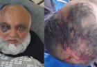 সাতক্ষীরা কলারোয়ায় জমি দখলকে কেন্দ্র করে প্রতিপক্ষের হামলায়  আহত ৩ জন ॥ থানায় মামলা নেয়ার নির্দেশ আদালতের