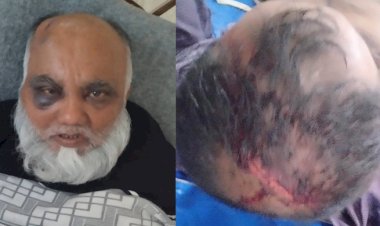সাতক্ষীরা কলারোয়ায় জমি দখলকে কেন্দ্র করে প্রতিপক্ষের হামলায়  আহত ৩ জন ॥ থানায় মামলা নেয়ার নির্দেশ আদালতের