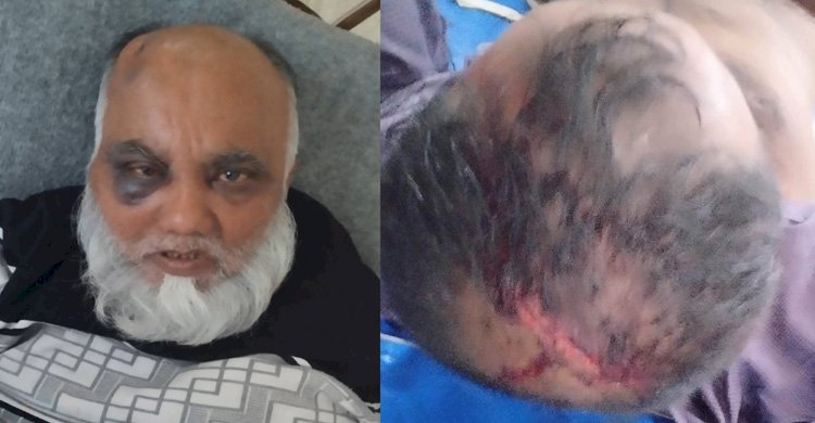 সাতক্ষীরা কলারোয়ায় জমি দখলকে কেন্দ্র করে প্রতিপক্ষের হামলায়  আহত ৩ জন ॥ থানায় মামলা নেয়ার নির্দেশ আদালতের